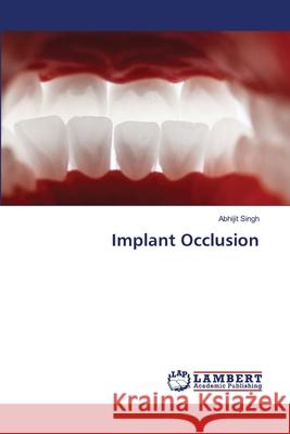 Implant Occlusion Singh, Abhijit 9786208443566