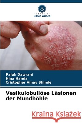 Vesikulobull?se L?sionen der Mundh?hle Palak Dawrani Hina Handa Cristopher Vinay Shinde 9786208445423