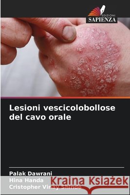 Lesioni vescicolobollose del cavo orale Palak Dawrani Hina Handa Cristopher Vinay Shinde 9786208446178