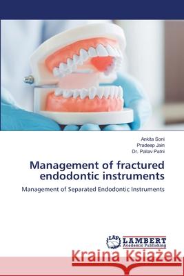 Management of fractured endodontic instruments Ankita Soni Pradeep Jain Pallav Patni 9786208447243