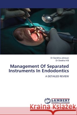 Management Of Separated Instruments In Endodontics Sandhra Johnson Swetha H 9786208447410