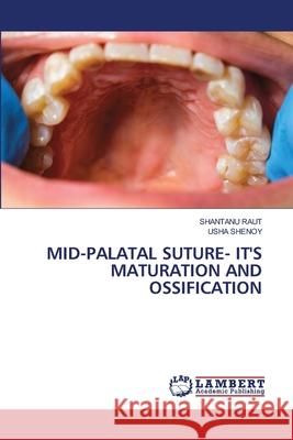 Mid-Palatal Suture- It's Maturation and Ossification Shantanu Raut Usha Shenoy 9786208452360