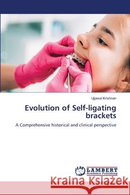 Evolution of Self-ligating brackets Krishnan, Ujjawal 9786208454456
