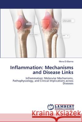 Inflammation: Mechanisms and Disease Links El-Banna, Mona 9786208455583