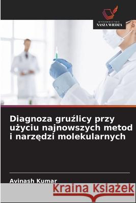 Diagnoza gruzlicy przy uzyciu najnowszych metod i narzedzi molekularnych Kumar, Avinash 9786208458218