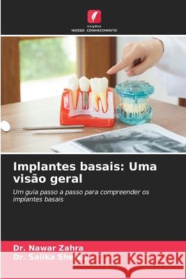 Implantes basais: Uma visão geral Zahra, Dr. Nawar, Sheikh, Dr. Salika 9786208463298 Edições Nosso Conhecimento