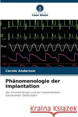 Phänomenologie der Implantation Anderson, Carole 9786208464455 Verlag Unser Wissen