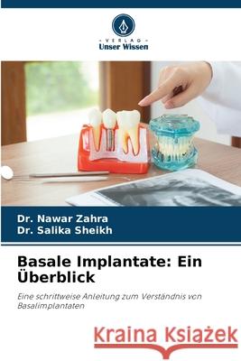 Basale Implantate: Ein Überblick Zahra, Dr. Nawar, Sheikh, Dr. Salika 9786208465858 Verlag Unser Wissen