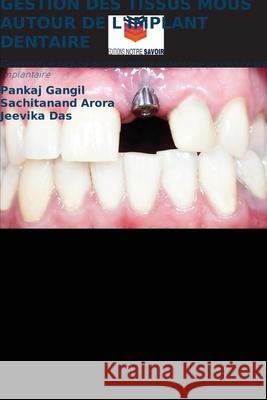 GESTION DES TISSUS MOUS AUTOUR DE L'IMPLANT DENTAIRE Gangil, Pankaj, Arora, Sachitanand, Das, Jeevika 9786208466060