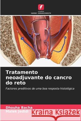 Tratamento neoadjuvante do cancro do reto Bacha, Dhouha, Jedidi, Malek 9786208468422 Edições Nosso Conhecimento