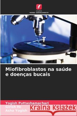 Miofibroblastos na saúde e doenças bucais Puttashamachari, Yogish, Hc, Girish, Yogish, Asha 9786208470098 Edições Nosso Conhecimento