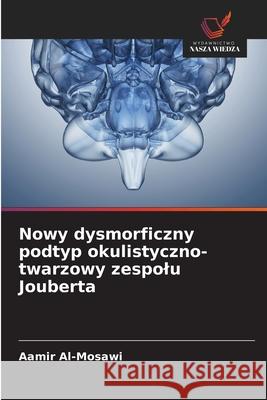 Nowy dysmorficzny podtyp okulistyczno-twarzowy zespolu Jouberta Al-Mosawi, Aamir 9786208470494 Wydawnictwo Nasza Wiedza