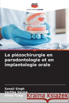 La piézochirurgie en parodontologie et en implantologie orale Singh, Sonali, Verma, Vartika, Tyagi, Shilpi 9786208472344
