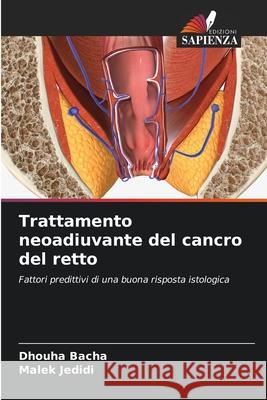Trattamento neoadiuvante del cancro del retto Bacha, Dhouha, Jedidi, Malek 9786208478667 Edizioni Sapienza