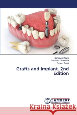 Grafts and Implant. 2nd Edition Rana, Saraswati, Chandhok, Tushyata, Dangi, Pawan 9786208479039