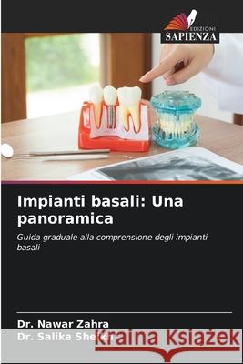 Impianti basali: Una panoramica Zahra, Dr. Nawar, Sheikh, Dr. Salika 9786208483777 Edizioni Sapienza