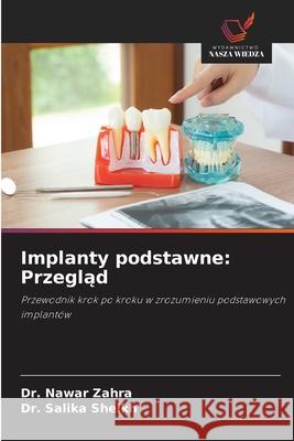 Implanty podstawne: Przeglad Zahra, Dr. Nawar, Sheikh, Dr. Salika 9786208486334 Wydawnictwo Nasza Wiedza