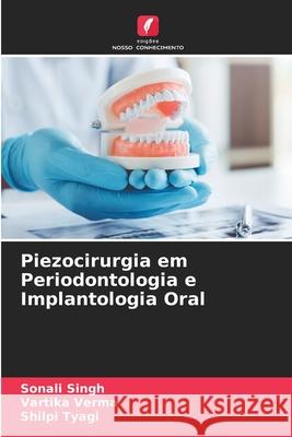 Piezocirurgia em Periodontologia e Implantologia Oral Singh, Sonali, Verma, Vartika, Tyagi, Shilpi 9786208487706