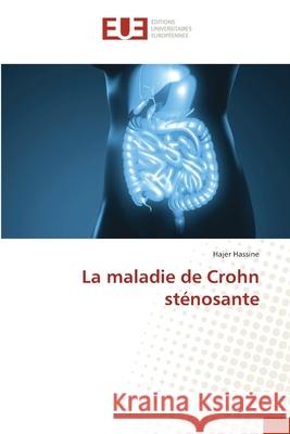 La maladie de Crohn sténosante Hassine, Hajer 9786208493066