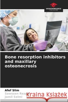Bone resorption inhibitors and maxillary osteonecrosis Slim, Afef, rezgui, Sawssen, Selmi, Jamil 9786208494230