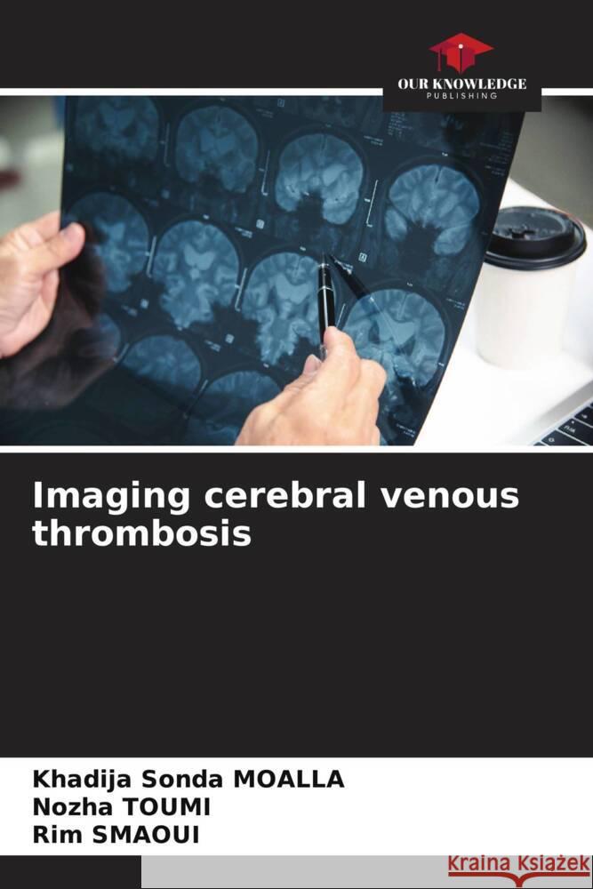 Imaging cerebral venous thrombosis MOALLA, Khadija Sonda, Toumi, Nozha, SMAOUI, Rim 9786208531584