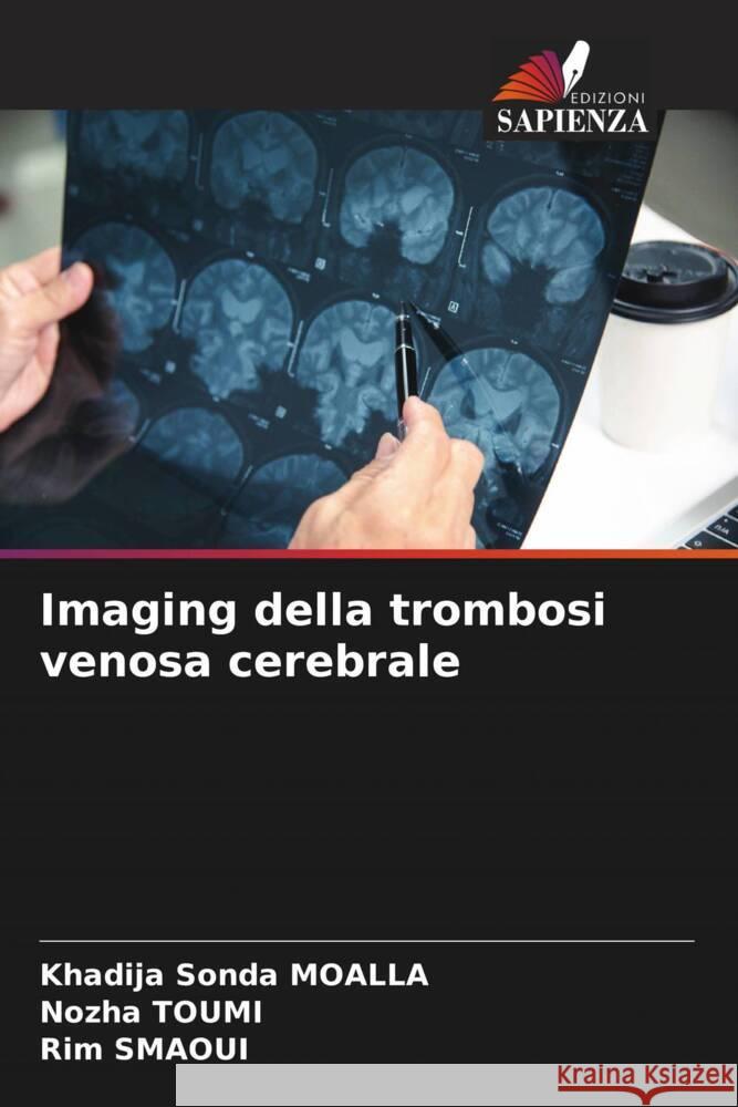 Imaging della trombosi venosa cerebrale MOALLA, Khadija Sonda, Toumi, Nozha, SMAOUI, Rim 9786208531607