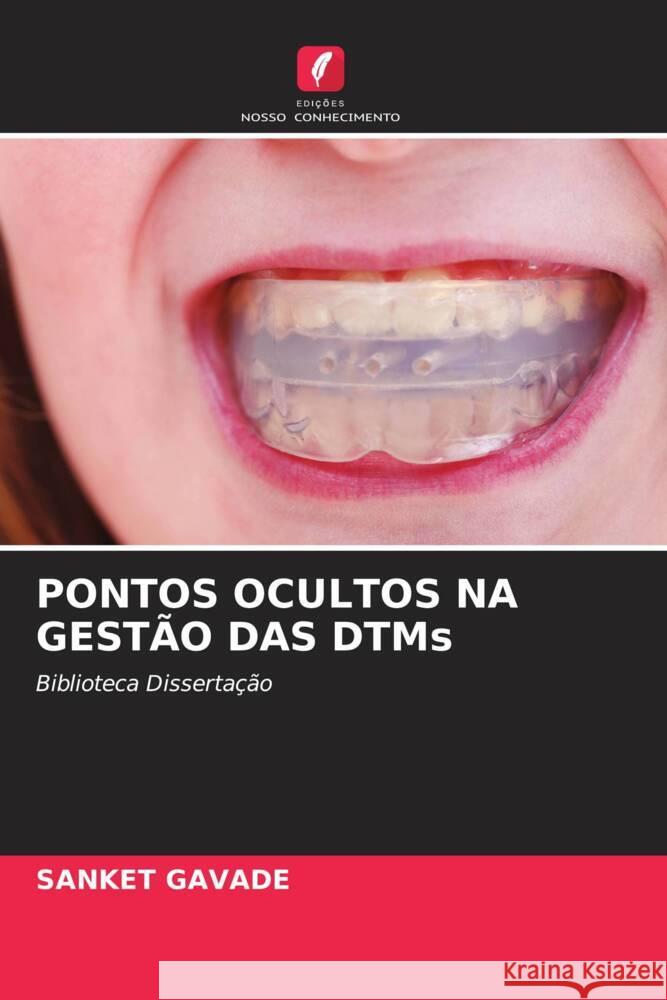 PONTOS OCULTOS NA GESTÃO DAS DTMs GAVADE, SANKET 9786208532147