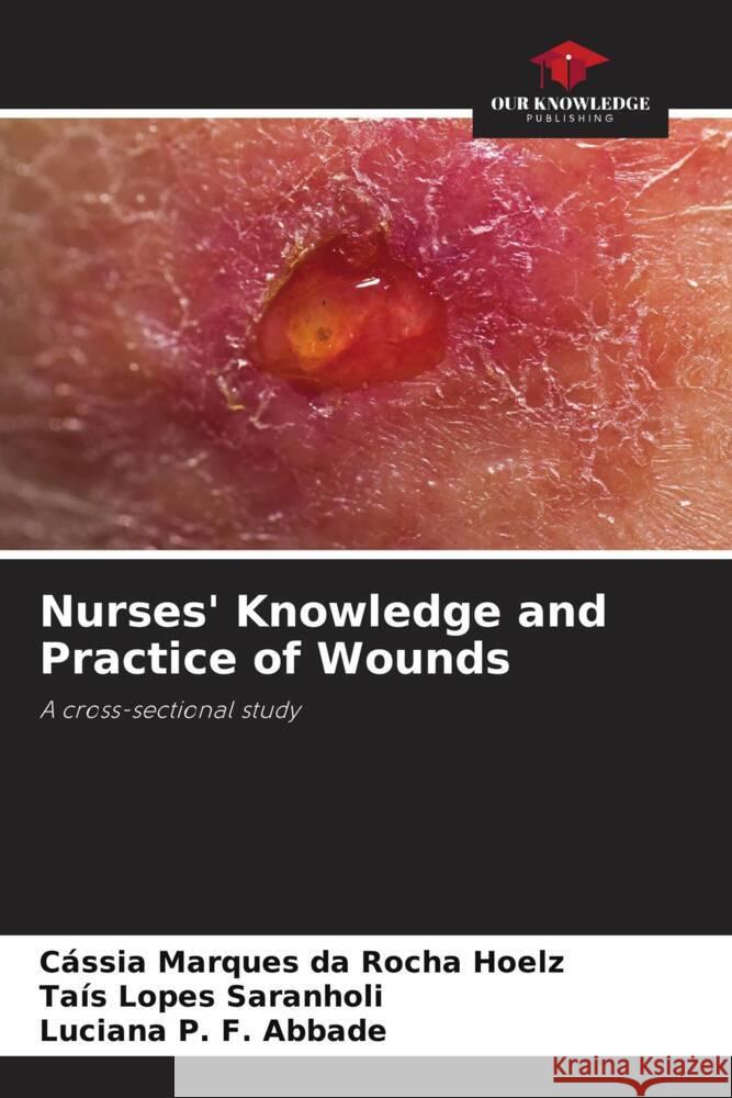 Nurses' Knowledge and Practice of Wounds C?ssia Marques Da Rocha Hoelz Ta?s Lopes Saranholi Luciana P. F. Abbade 9786208536237