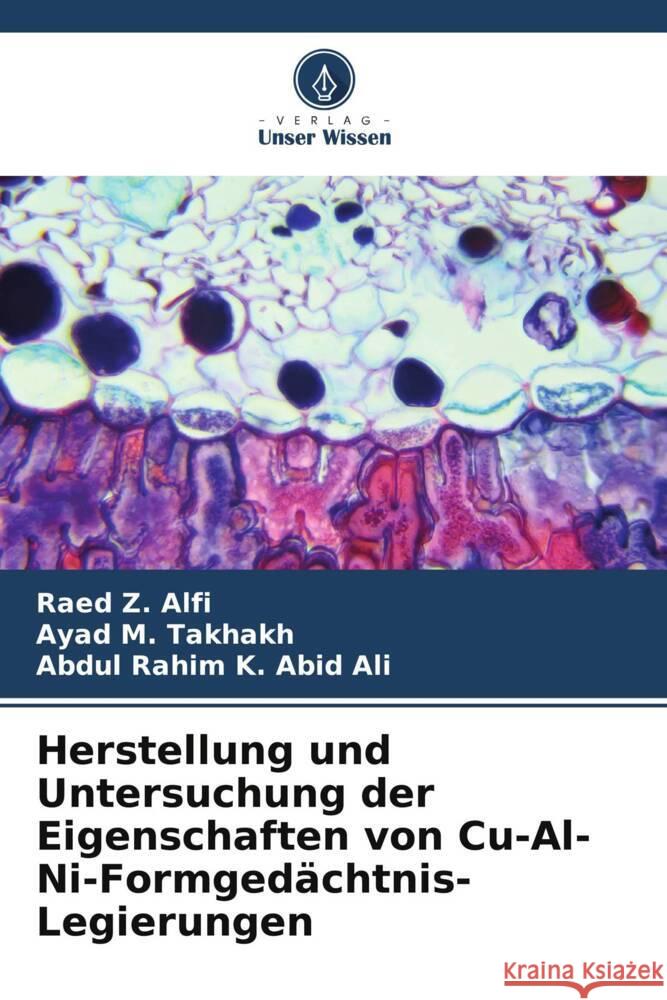 Herstellung und Untersuchung der Eigenschaften von Cu-Al-Ni-Formgedächtnis-Legierungen Alfi, Raed Z., Takhakh, Ayad M., Abid Ali, Abdul Rahim K. 9786208544126 Verlag Unser Wissen