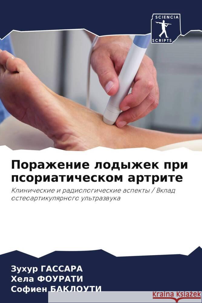 Porazhenie lodyzhek pri psoriaticheskom artrite GASSARA, Zuhur, Fourati, Hela, Baklouti, Sofien 9786208546427