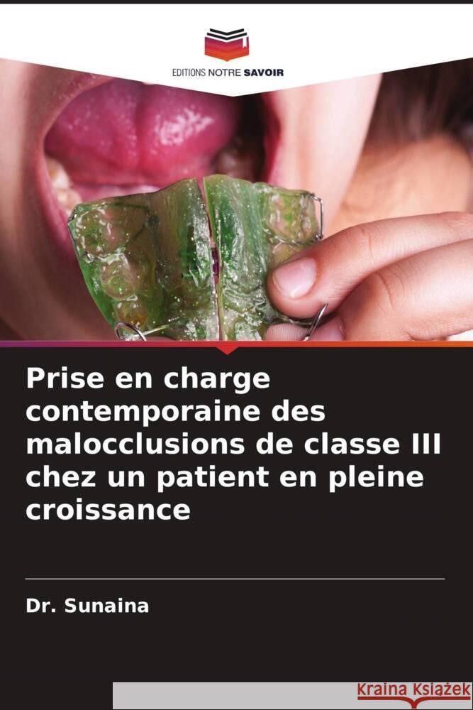 Prise en charge contemporaine des malocclusions de classe III chez un patient en pleine croissance Sunaina, Dr. 9786208551698