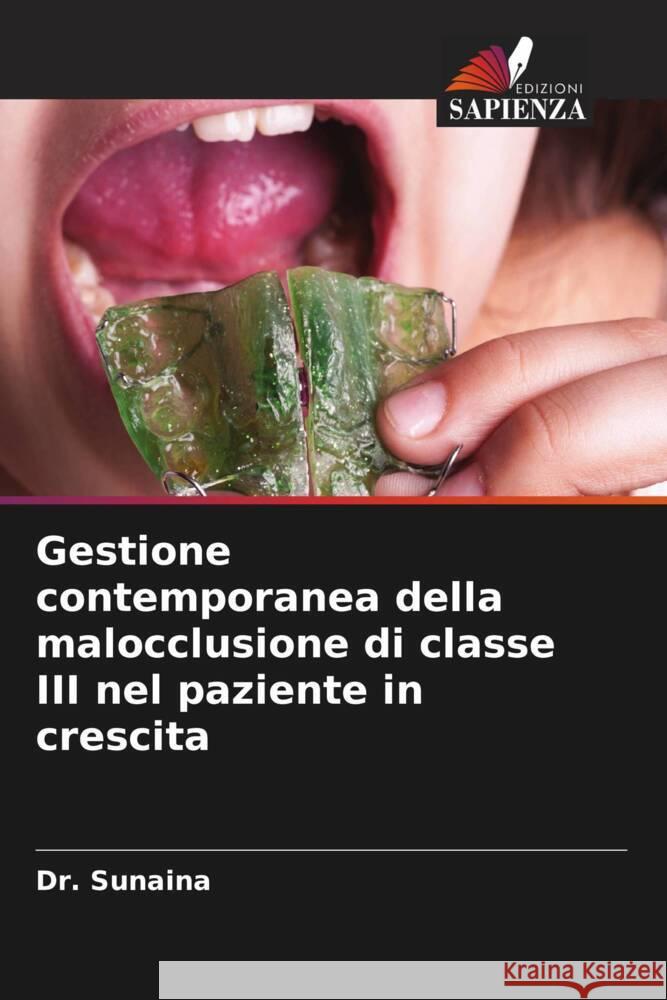 Gestione contemporanea della malocclusione di classe III nel paziente in crescita Sunaina, Dr. 9786208551704