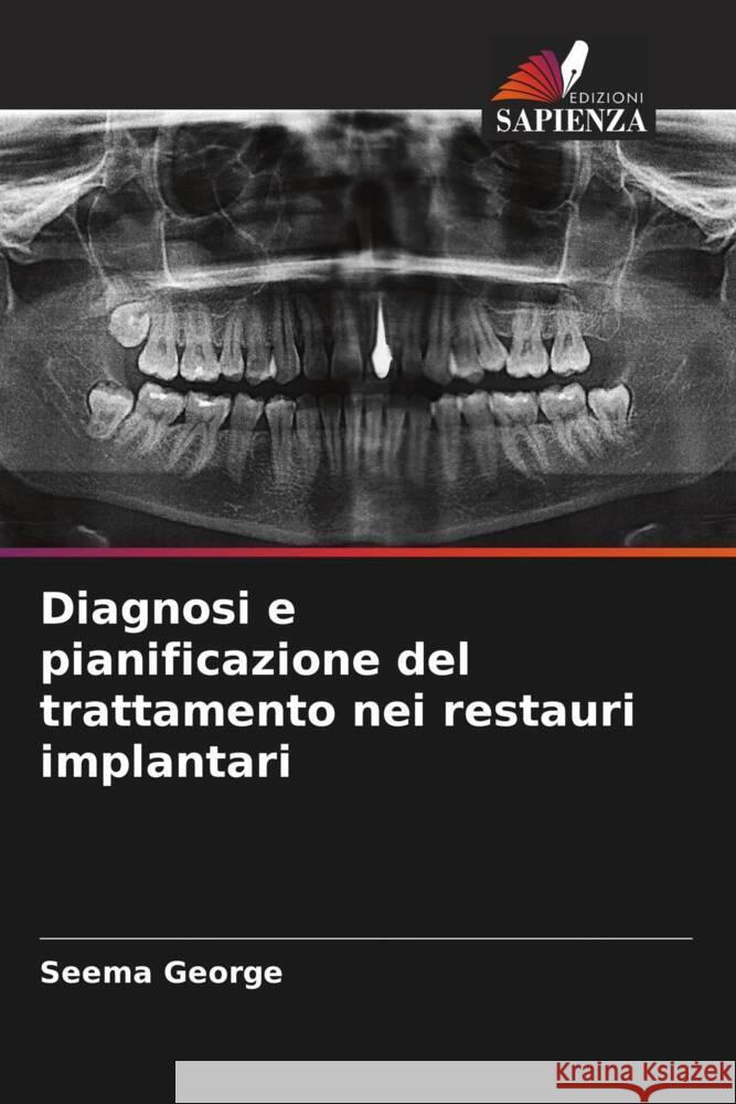 Diagnosi e pianificazione del trattamento nei restauri implantari George, Seema 9786208562724