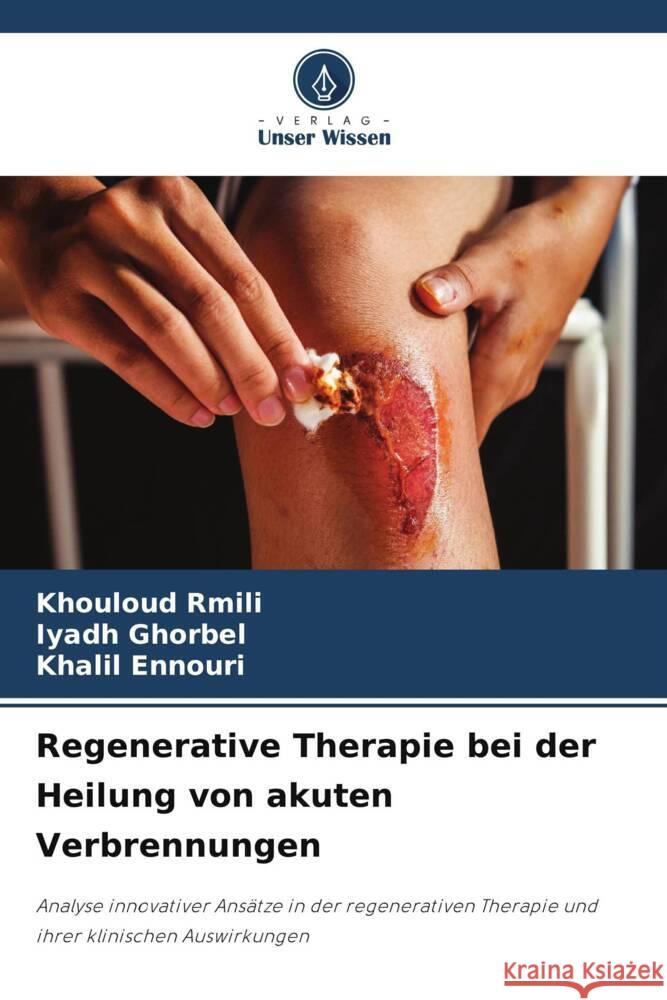 Regenerative Therapie bei der Heilung von akuten Verbrennungen Rmili, Khouloud, Ghorbel, Iyadh, Ennouri, Khalil 9786208574758
