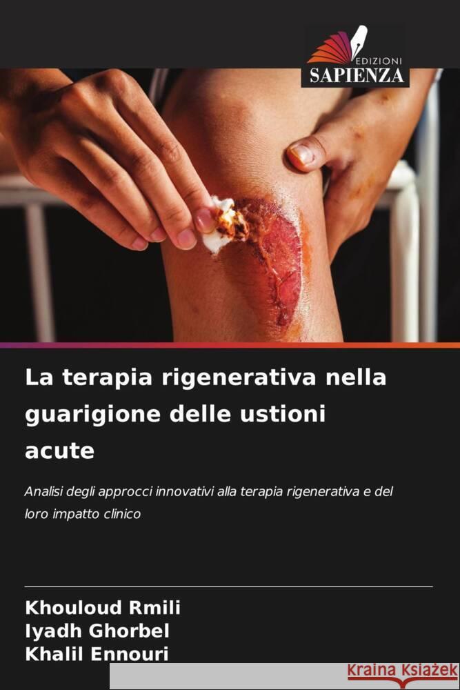 La terapia rigenerativa nella guarigione delle ustioni acute Rmili, Khouloud, Ghorbel, Iyadh, Ennouri, Khalil 9786208574819