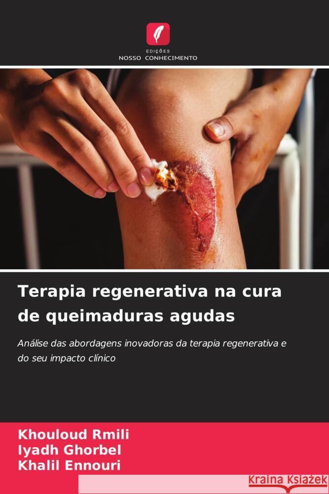 Terapia regenerativa na cura de queimaduras agudas Rmili, Khouloud, Ghorbel, Iyadh, Ennouri, Khalil 9786208574826