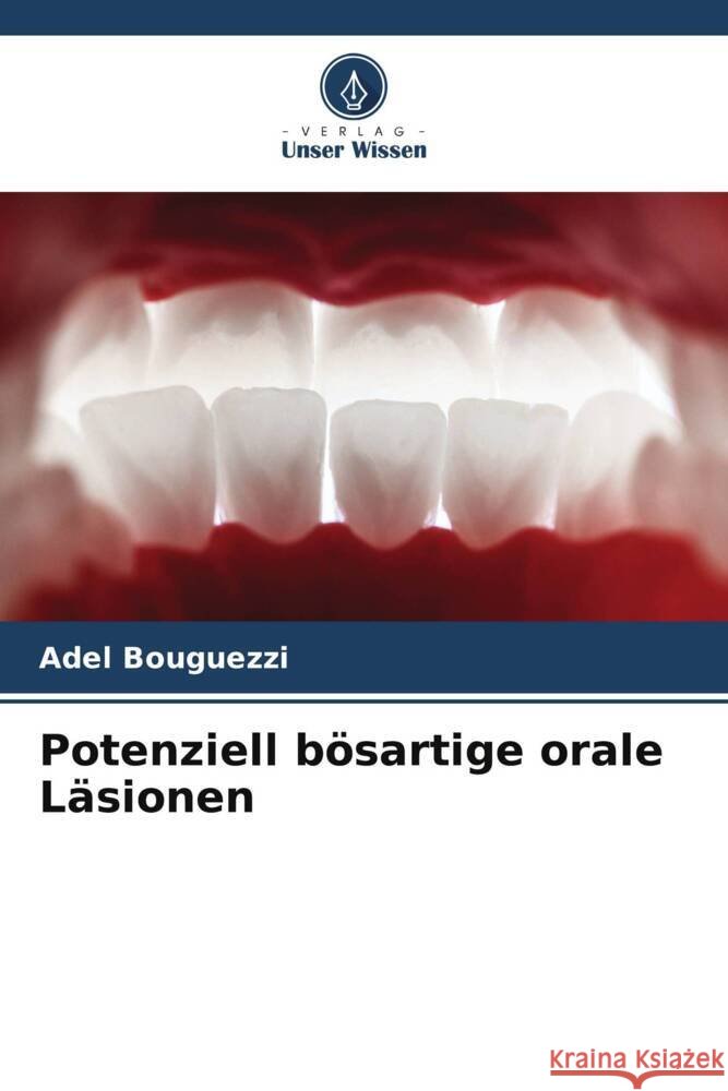 Potenziell b?sartige orale L?sionen Adel Bouguezzi 9786208580285 Verlag Unser Wissen
