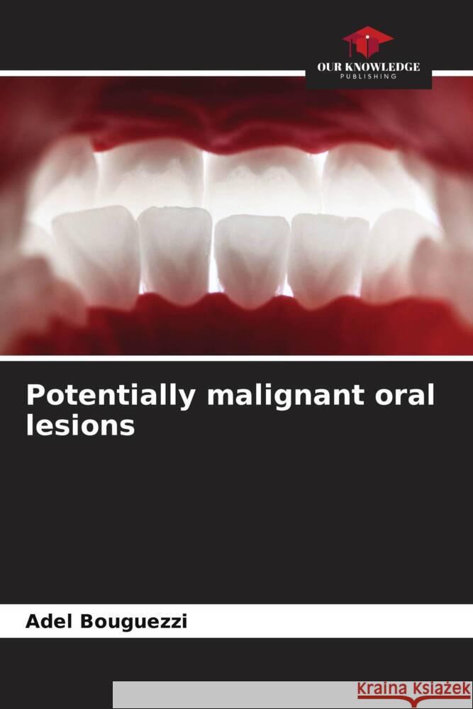 Potentially malignant oral lesions Adel Bouguezzi 9786208580292