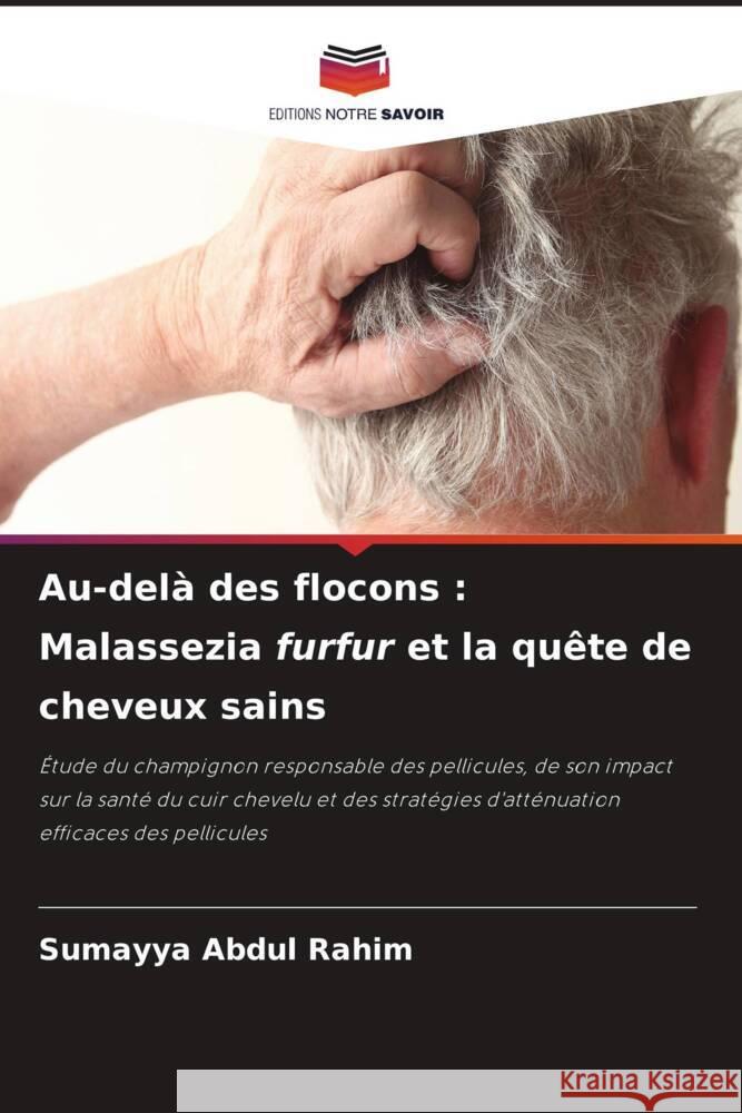 Au-delà des flocons : Malassezia furfur et la quête de cheveux sains Abdul Rahim, Sumayya 9786208584092