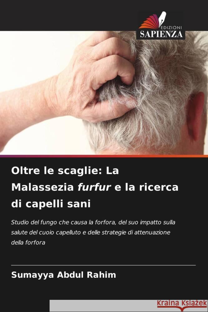 Oltre le scaglie: La Malassezia furfur e la ricerca di capelli sani Abdul Rahim, Sumayya 9786208584108