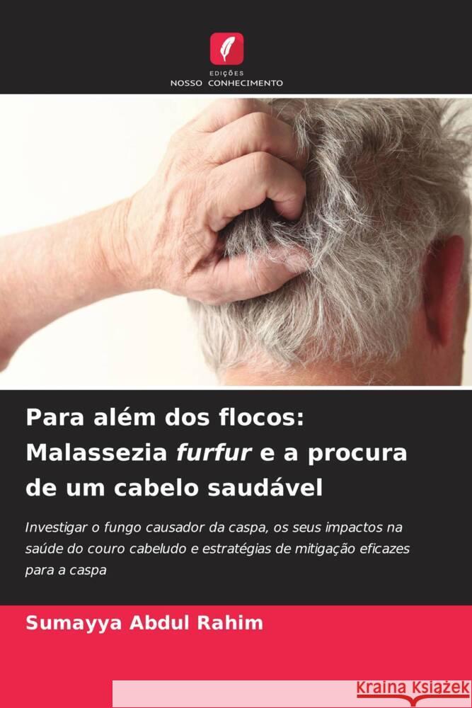 Para além dos flocos: Malassezia furfur e a procura de um cabelo saudável Abdul Rahim, Sumayya 9786208584115