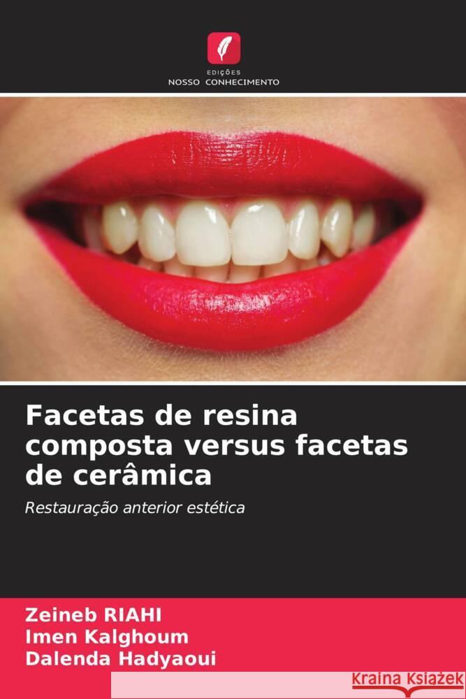 Facetas de resina composta versus facetas de cerâmica Riahi, Zeineb, Kalghoum, Imen, Hadyaoui, Dalenda 9786208587987 Edições Nosso Conhecimento