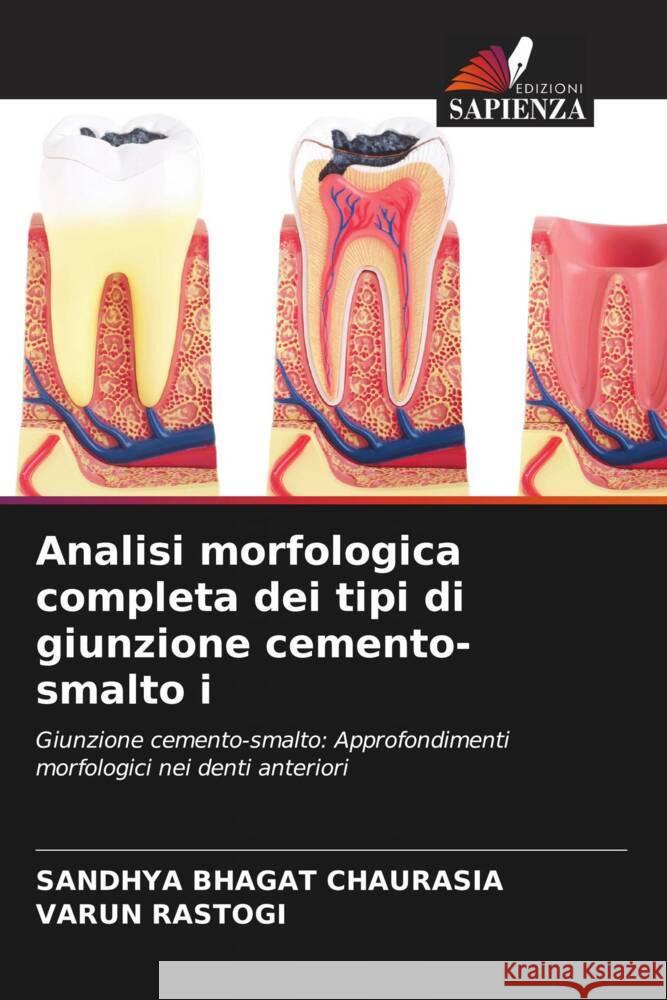 Analisi morfologica completa dei tipi di giunzione cemento-smalto i CHAURASIA, SANDHYA BHAGAT, Rastogi, Varun 9786208588212