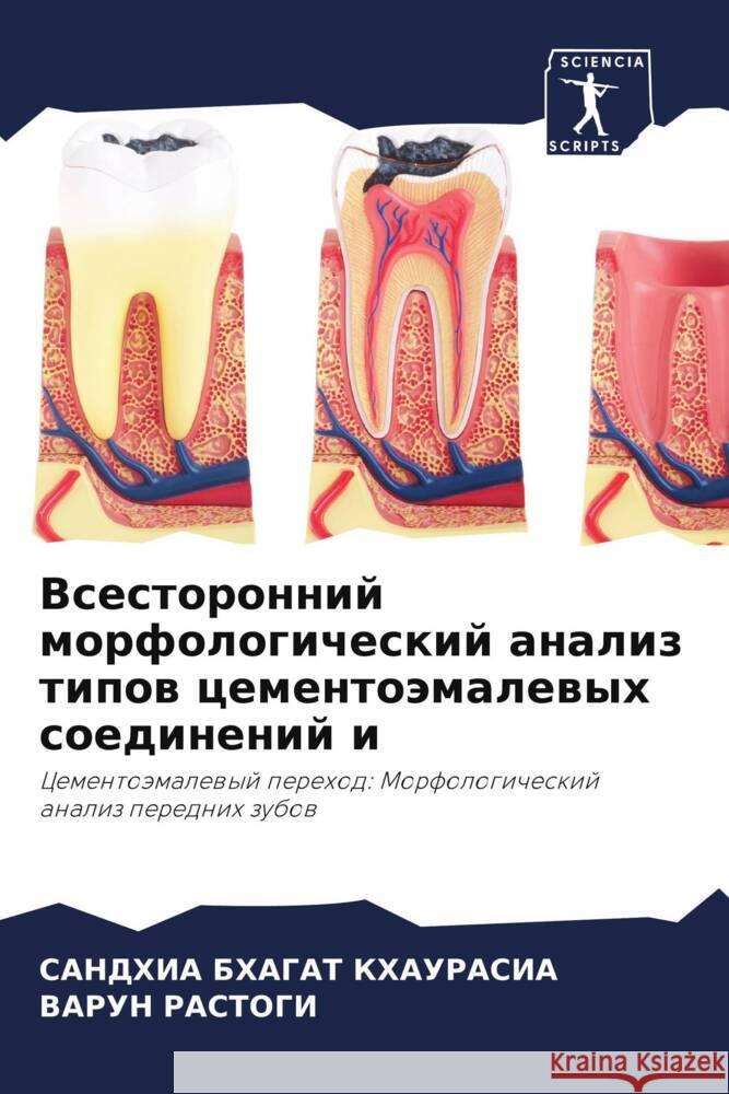 Vsestoronnij morfologicheskij analiz tipow cementoämalewyh soedinenij i KHAURASIA, SANDHIA BHAGAT, Rastogi, Varun 9786208588236