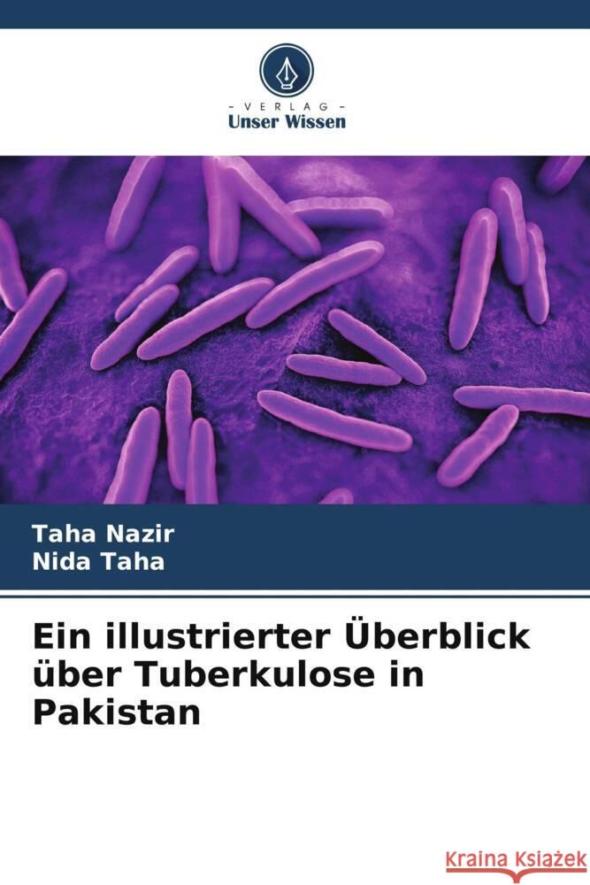 Ein illustrierter Überblick über Tuberkulose in Pakistan Nazir, Taha, Taha, Nida 9786208599669