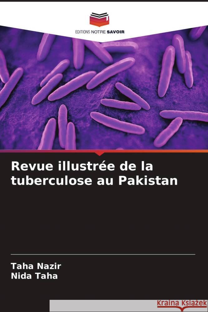 Revue illustrée de la tuberculose au Pakistan Nazir, Taha, Taha, Nida 9786208599683