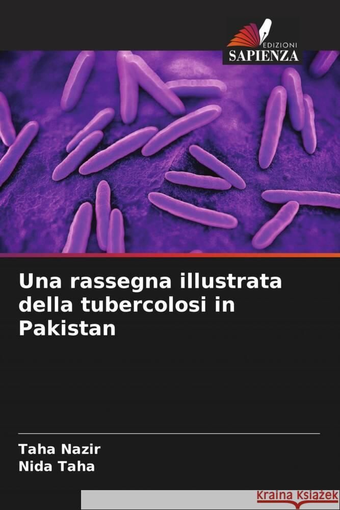 Una rassegna illustrata della tubercolosi in Pakistan Nazir, Taha, Taha, Nida 9786208599690