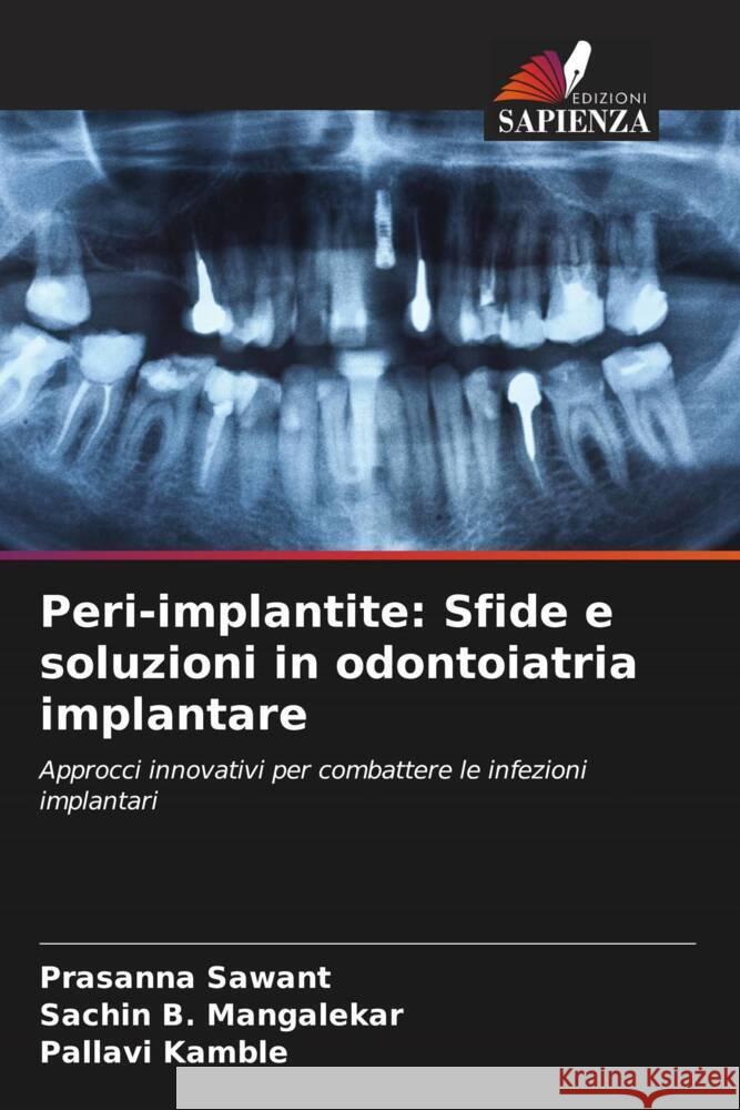 Peri-implantite: Sfide e soluzioni in odontoiatria implantare Prasanna Sawant Sachin B. Mangalekar Pallavi Kamble 9786208611576