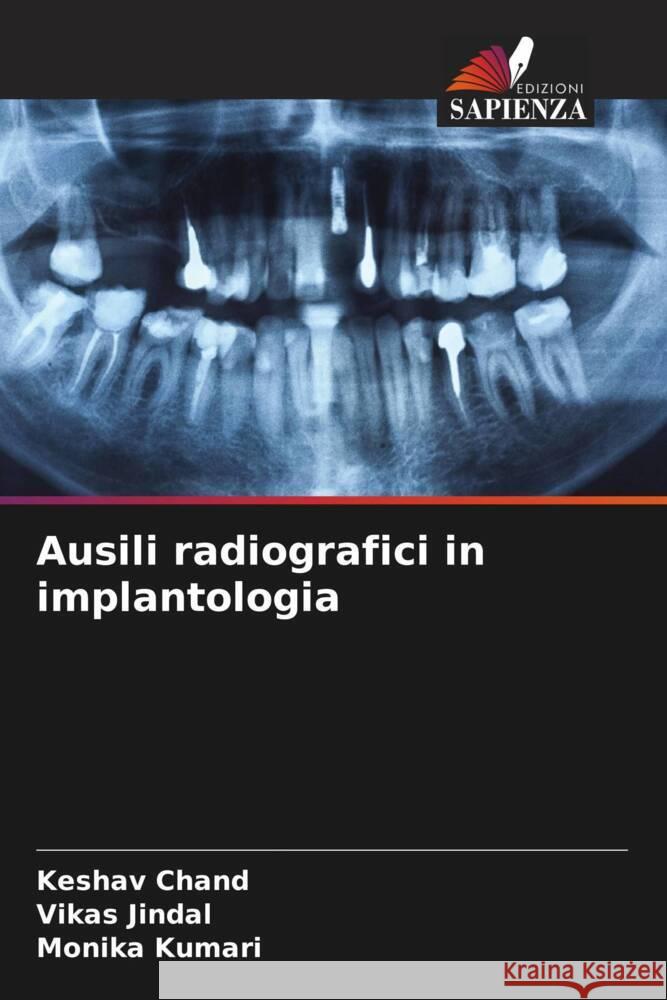 Ausili radiografici in implantologia Chand, Keshav, Jindal, Vikas, Kumari, Monika 9786208618131