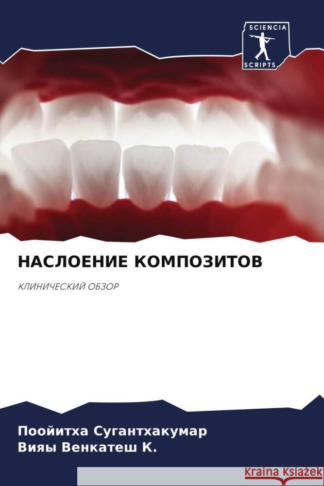 NASLOENIE KOMPOZITOV Suganthakumar, Poojitha, Venkatesh K., Viqy 9786208622961